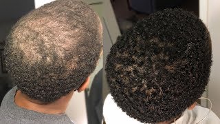 My 100 Natural HAIR GROWTH Serum  2 Month Update  GrowWithMe  Nia Hope [upl. by Anneg]