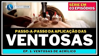 VENTOSATERAPIA  PASSOAPASSO para Aplicar as Ventosas de Acrílico AULA 13 [upl. by Warfold]