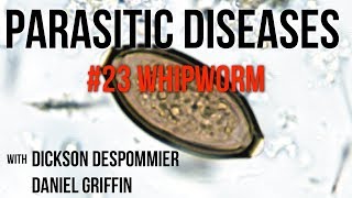 Parasitic Diseases Lectures 23 Whipworm [upl. by Showker707]