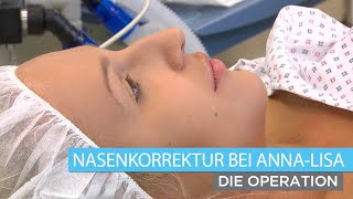 Nasenkorrektur bei AnnaLisa  Teil 34 Die Operation  Dr Jörg Knabl [upl. by Er]