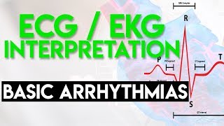 Cardiac Axis Determination  ECG Axis  Simplified [upl. by Scharaga]