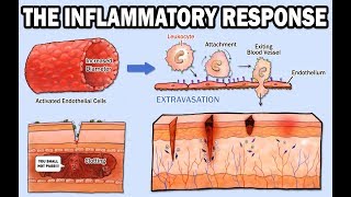 THE INFLAMMATORY RESPONSE [upl. by Denice]