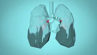 Air Pollution Health Impacts [upl. by Bright]