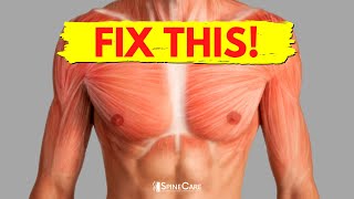 How to Fix Chest Muscle Tightness in 30 SECONDS [upl. by Four]