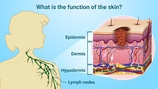 Understanding Melanoma [upl. by Magas]