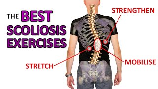 THE Best Exercises For Scoliosis [upl. by Freiman]