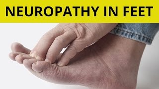 Peripheral Neuropathy Isnt Permanent Reverse Painful Symptoms with Treatment [upl. by Khichabia346]