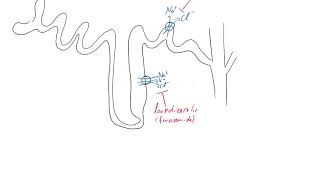 Hyperkalemia Explained Clearly  Fluid and Electrolyte Imbalances [upl. by Sculley]