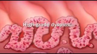 The Oesophagus Esophagus  Clinical Anatomy [upl. by Labannah]