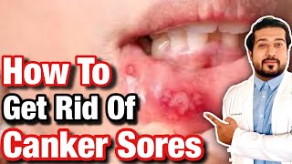 How to Get Rid of Canker Sores According to Science [upl. by Cindra75]