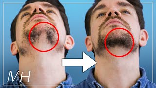 How To Fix Your Patchy Beard… Fast [upl. by Curson]