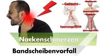 NACKENSCHMERZEN amp HWS Bandscheibenvorfall  Symptome Ursachen amp Lösungen [upl. by Legnaros929]