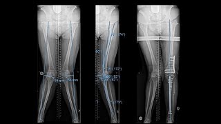 Knee bones and ligaments [upl. by Artcele]