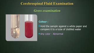 Cerebrospinal Fluid Examination CSF [upl. by Minette]