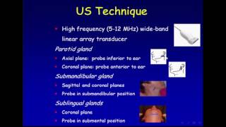 Ultrasound of the Salivary Glands [upl. by Nnylirej]