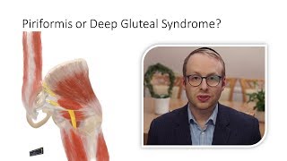 Piriformis Syndrome or Deep Gluteal Syndrome [upl. by Shaeffer]