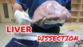 Anatomy Dissection of Liver [upl. by Zetrauq860]