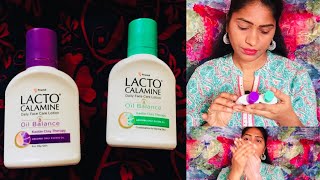 Lacto Calamine Review In தமிழ் [upl. by Alfonso]