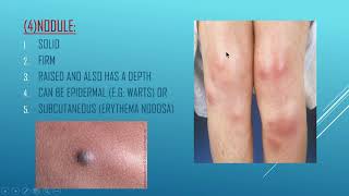 Understanding skin lesions part 1 [upl. by Erhard]