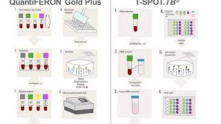 Interferon Gamma Release Assays IGRAs [upl. by Aiyt]