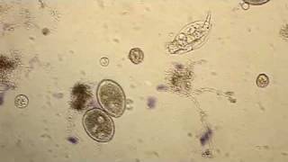 Wastewater Ciliates [upl. by Lraed]