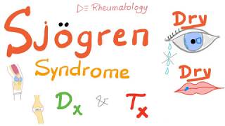 Sjögren Syndrome Diagnosis and Management [upl. by Inez]