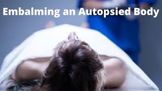 Embalming an autopsied body [upl. by Vikki]