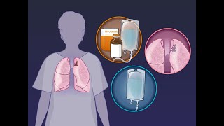 Neoadjuvant Nivolumab in Resectable Lung Cancer  NEJM [upl. by Arda247]