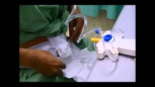 Continuous Ambulatory Peritoneal Dialysis [upl. by Tracee916]