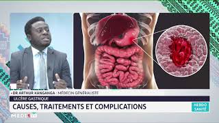 Ulcère gastrique causes traitements et complications [upl. by Orabla585]