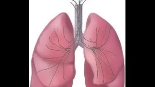 BREATH SOUNDS Stages of Fluid Overload Pneumonia [upl. by Kilmarx755]