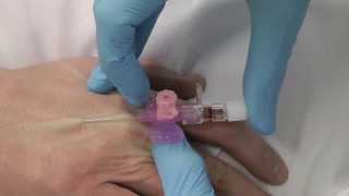 Advanced Clinical Skills Arterial Line Insertion [upl. by Marian]