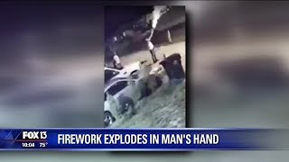 Video shows firework exploding in Lakeland mans hand [upl. by Izak353]