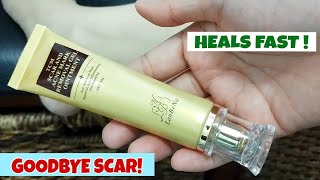 HOW TO HEAL SCAR FASTLANBENA SCAR REMOVER [upl. by Melvyn]