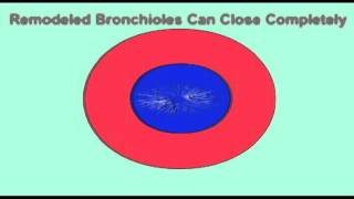 AP2 EXAM 2 BRONCHOCONSTRICTION amp BRONCHODILATIONavi [upl. by Karalynn]