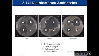 Pharmacology Urinary tract Infections MADE EASY [upl. by Doll]