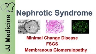 Nephrotic Syndrome  Clinical Presentation Causes and Treatment [upl. by Ashelman]