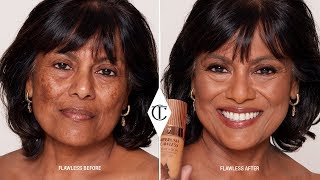 So You have PIH  Chemical Peel Help  Dark Skin  Hyperpigmentation Treatment  Pretreatment [upl. by Meador]