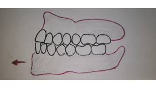 CONCEPTS OF OCCLUSION IN FIXED PROSTHODONTICS [upl. by Llerrud127]