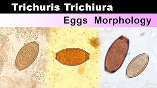 Trichuris Trichiura eggs Morphology  Clear Explain [upl. by Westlund516]