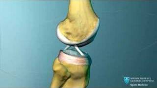 Knee Ligament Anatomy Animation [upl. by Asilat88]