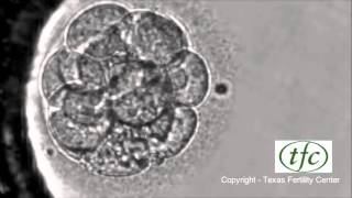 Human Embryo Growing from Fertilization to Day 6 Blastocyst [upl. by Eima114]