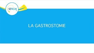 Nutrition entérale  gastrostomie [upl. by Airamasor]