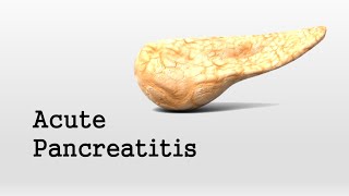 Acute Pancreatitis [upl. by Asa]