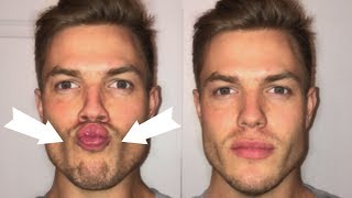 3 Exercises To Lose CHUBBY Cheeks Get a Defined Face [upl. by Shakespeare713]