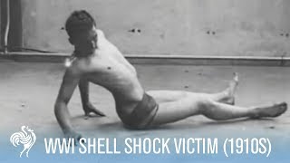 World War 1 Shell Shock Victim Recovery 1910s  War Archives [upl. by Llenrahs988]