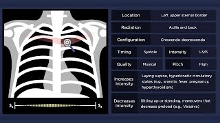 Pulmonary Flow Murmur [upl. by Erle185]