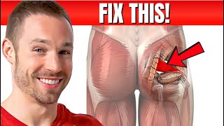 How To Fix Piriformis Syndrome Causes Symptoms Treatment [upl. by Fidelis]