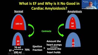 Anemia in Chronic Kidney Disease [upl. by Janie]