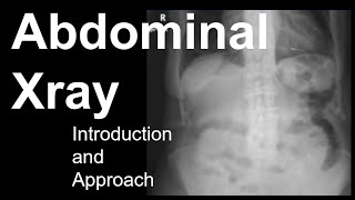 Abdominal Xray Introduction and Approach [upl. by Niwred624]